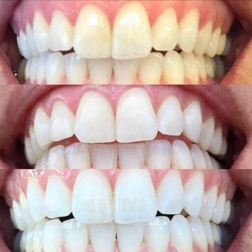 Whitening Toothpaste - Picture 3 of 3